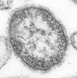 The measles virus