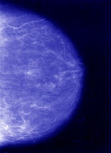 Photo of a mammogram