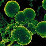 Photo of bacteria