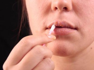 Photo of a woman treating a cold sore