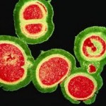 Photo of MRSA bacteria