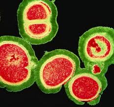 Photo of MRSA bacteria