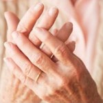 Photo of arthritic hands