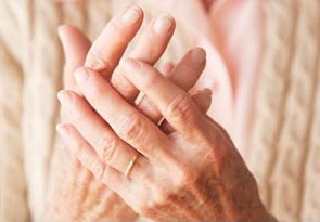 Photo of arthritic hands