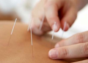 Photo of abdominal acupuncture