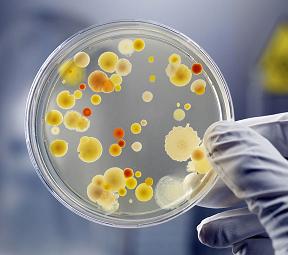 Photo of a petri dish containing resistant bacteria