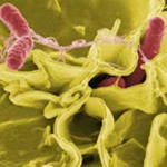 photo of salmonella bacterium