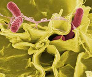 photo of salmonella bacterium